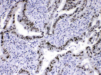 HnRNP A1/HNRNPA1 Antibody