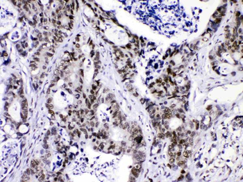 HnRNP F/HNRNPF Antibody