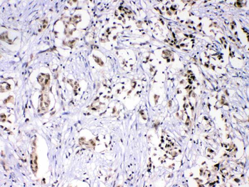 HnRNP F/HNRNPF Antibody