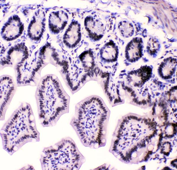HnRNP F/HNRNPF Antibody