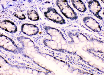 HnRNP F/HNRNPF Antibody
