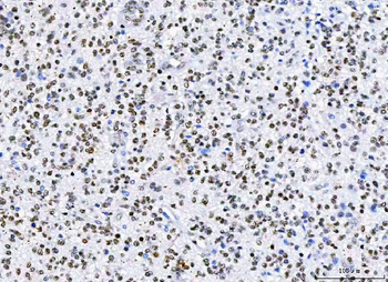 HnRNP H/HNRNPH1 Antibody
