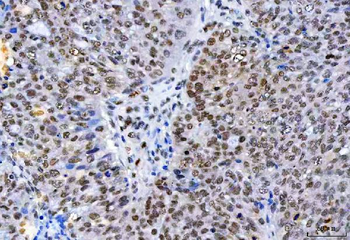 HnRNP H/HNRNPH1 Antibody