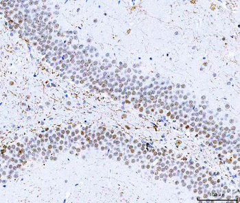 HnRNP H/HNRNPH1 Antibody