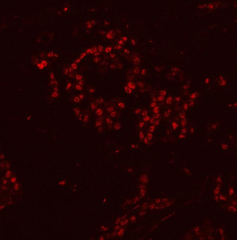 HnRNP H/HNRNPH1 Antibody