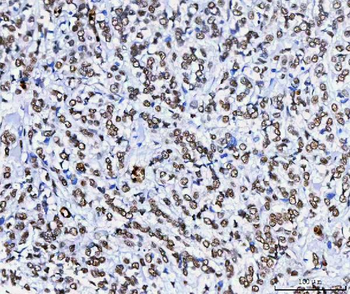 HnRNP H/HNRNPH1 Antibody