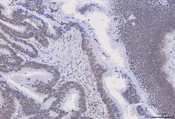 HnRNP H/HNRNPH1 Antibody