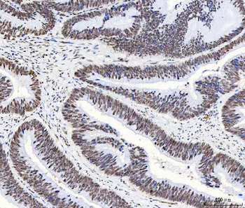 HnRNP H/HNRNPH1 Antibody