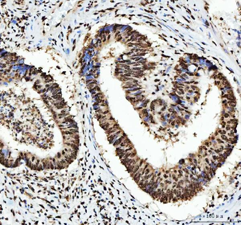 HnRNP L/HNRNPL Antibody