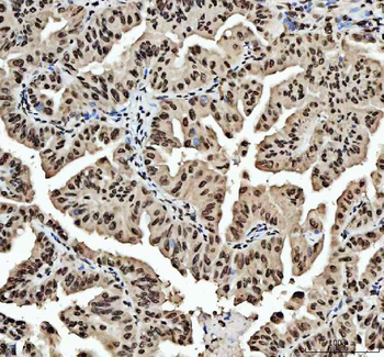 HnRNP L/HNRNPL Antibody
