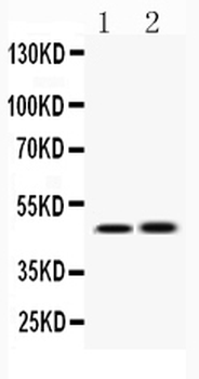 IKK gamma/IKBKG Rabbit Polyclonal Antibody