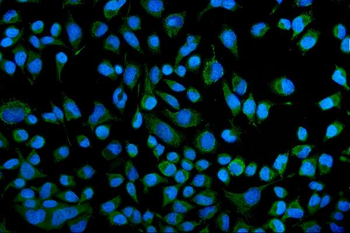 KCNQ1 Rabbit Polyclonal Antibody