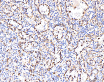KCNQ1 Rabbit Polyclonal Antibody