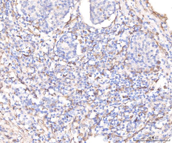 KCNQ1 Rabbit Polyclonal Antibody