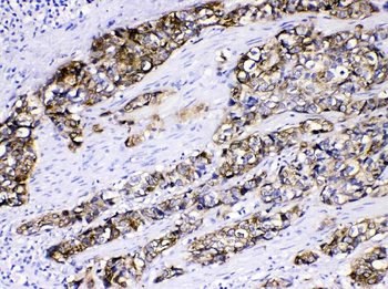 Cytokeratin 5/KRT5 Rabbit Polyclonal Antibody