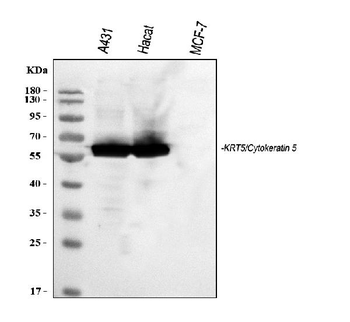 Cytokeratin 5/KRT5 Rabbit Polyclonal Antibody