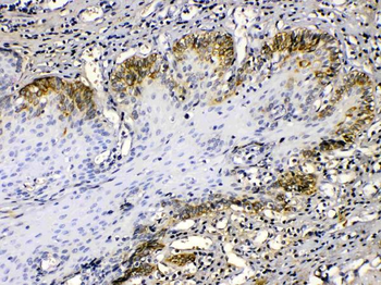 Cytokeratin 14/KRT14 Rabbit Polyclonal Antibody