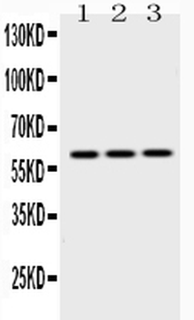 Cytokeratin 14/KRT14 Rabbit Polyclonal Antibody