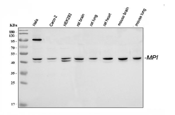 Mannose Phosphate Isomerase/MPI Rabbit Polyclonal Antibody
