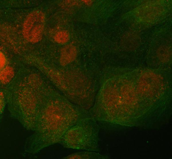 ST7 Rabbit Polyclonal Antibody