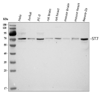 ST7 Rabbit Polyclonal Antibody