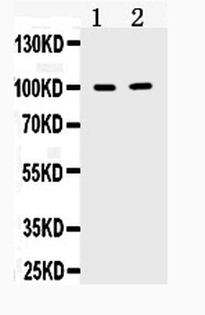 TACC1 Rabbit Polyclonal Antibody