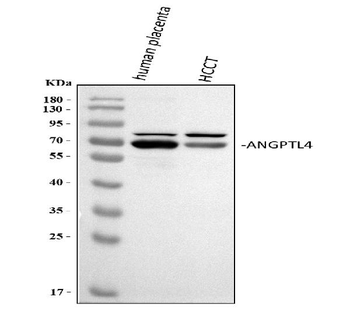 Angiopoietin-like 4/ANGPTL4 Rabbit Polyclonal Antibody