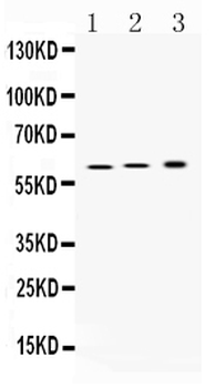Hydrogen Potassium ATPase Beta/ATP4B Rabbit Polyclonal Antibody