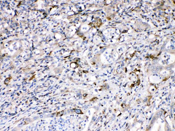 Bax Antibody