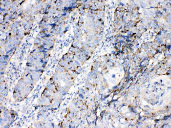 Bax Antibody