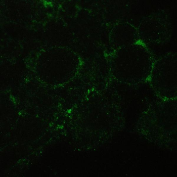 CD147/Emmprin/BSG Antibody