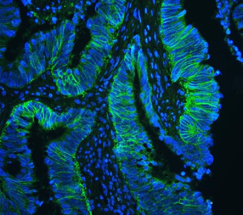 CD147/Emmprin/BSG Antibody