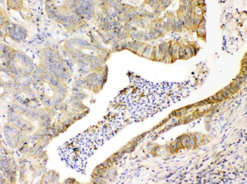 CD147/Emmprin/BSG Antibody