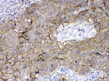 CD147/Emmprin/BSG Antibody
