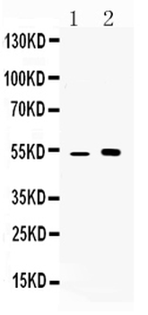 CDR2 Rabbit Polyclonal Antibody