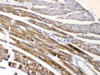 Nicotinic Acetylcholine Receptor alpha 5/CHRNA5 Antibody