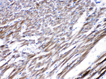 Nicotinic Acetylcholine Receptor alpha 5/CHRNA5 Antibody