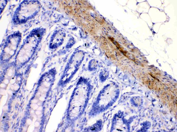 Nicotinic Acetylcholine Receptor alpha 5/CHRNA5 Antibody