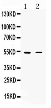 Nicotinic Acetylcholine Receptor alpha 5/CHRNA5 Antibody