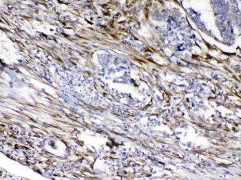 Cytoglobin/CYGB Rabbit Polyclonal Antibody
