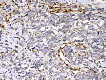 Cytoglobin/CYGB Rabbit Polyclonal Antibody