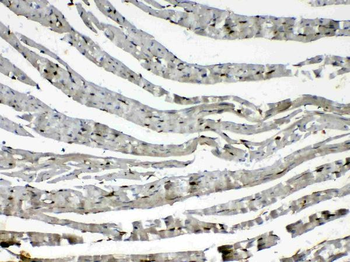 Cytoglobin/CYGB Rabbit Polyclonal Antibody
