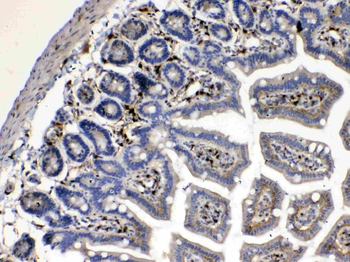 Cytoglobin/CYGB Rabbit Polyclonal Antibody