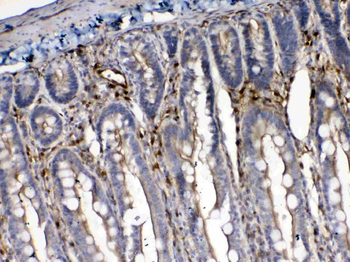 Cytoglobin/CYGB Rabbit Polyclonal Antibody