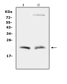 Cytoglobin/CYGB Rabbit Polyclonal Antibody