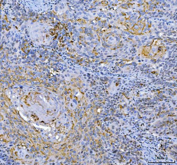 GAPDH Rabbit Polyclonal Antibody