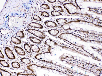 HMGB1 Antibody