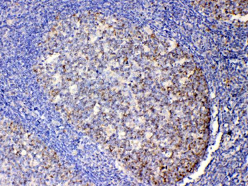 IL13 Rabbit Polyclonal Antibody