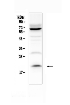 IL13 Rabbit Polyclonal Antibody