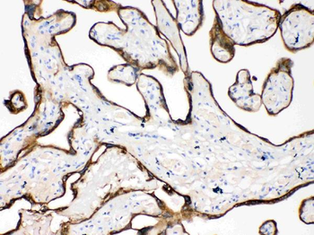 Cytokeratin 18/KRT18 Antibody